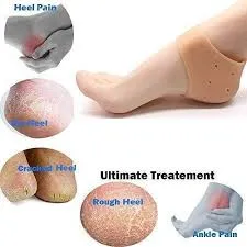 Anti Crack Heel Protection Silicone Set - View